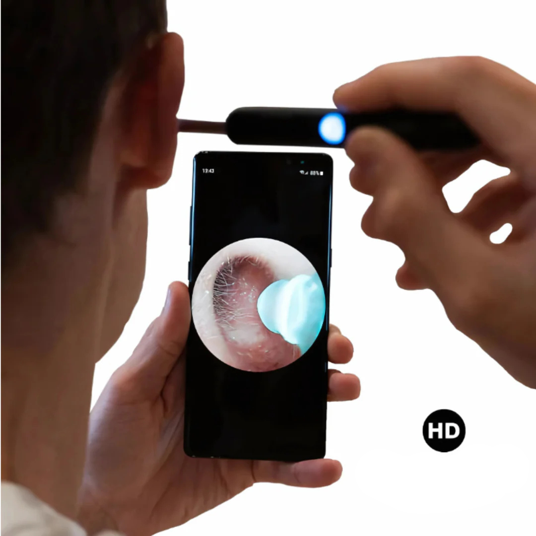 Aparat inteligent de Curățare a Urechilor cu Cameră